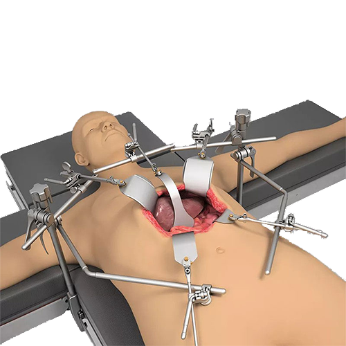pedazo ventaja Papá Thompson Surgical Instruments Retractor Systems - Novel Medical
